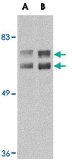 JPH2 Rabbit anti-Human, Mouse, Rat, Polyclonal Antibody, Abnova 100 &mu;g | Buy Online | Abnova Corporation | Fisher Scientific