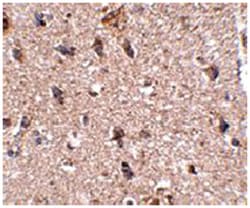 JPH3 Rabbit anti-Human, Mouse, Rat, Polyclonal Antibody, Abnova 100 &mu;g | Buy Online | Abnova Corporation | Fisher Scientific