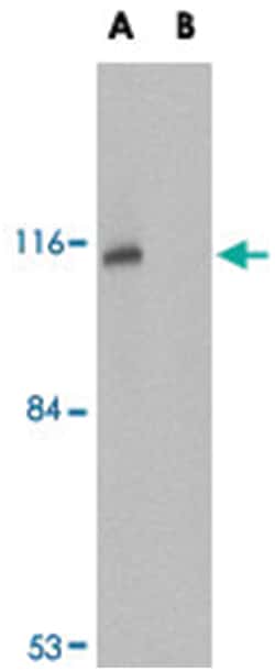 JPH3 Rabbit anti-Human, Mouse, Rat, Polyclonal Antibody, Abnova 100 &mu;g | Buy Online | Abnova Corporation | Fisher Scientific
