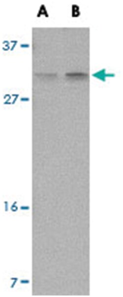 PIGY Rabbit anti-Human, Mouse, Polyclonal Antibody, Abnova 100&mu;g; Unlabeled:Antibodies,
