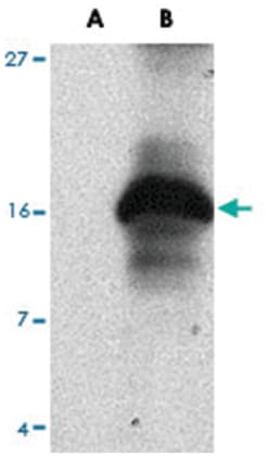 Strep-tag II Rabbit, Polyclonal Antibody, Abnova 100&mu;g; Unlabeled:Anticuerpos