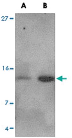 Strep-tag II Rabbit, Polyclonal Antibody, Abnova 100 &mu;g | Buy Online | Abnova Corporation | Fisher Scientific