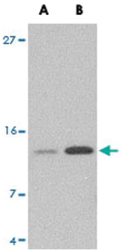 Strep-tag II Rabbit, Polyclonal Antibody, Abnova 100 &mu;g | Buy Online | Abnova | Fisher Scientific
