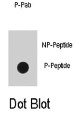 EGFR (phospho Y1016), Rabbit anti-Human, Polyclonal Antibody, Abnova 400&mu;L;