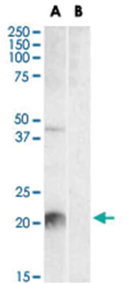 Klk6, Goat, Polyclonal Antibody, Abnova 100&mu;g; Unlabeled:Antibodies,