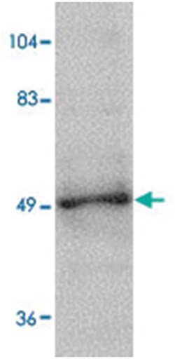 ZBTB2 Rabbit anti-Human, Mouse, Rat, Polyclonal Antibody, Abnova 100&mu;g;