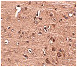 GLE1, Rabbit, Polyclonal Antibody, Abnova 100&mu;g; Unlabeled:Antibodies,