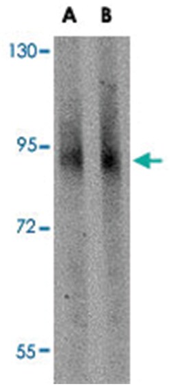 GLE1, Rabbit, Polyclonal Antibody, Abnova 100&mu;g; Unlabeled:Antibodies,