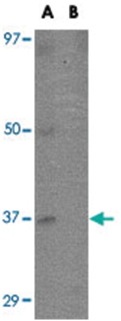 EBI3 Rabbit anti-Human, Mouse, Polyclonal Antibody, Abnova 100&mu;g; Unlabeled:Antibodies,