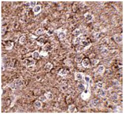 IL16 Rabbit anti-Human, Mouse, Rat, Polyclonal Antibody, Abnova 100&mu;g;
