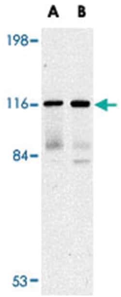 ZFYVE26, Rabbit, Polyclonal Antibody, Abnova 100&mu;g; Unlabeled:Antibodies,
