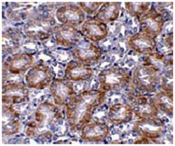 MTCH2 Rabbit anti-Human, Mouse, Polyclonal Antibody, Abnova 100&mu;g; Unlabeled:Antibodies,