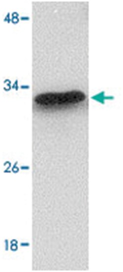 MTCH2 Rabbit anti-Human, Mouse, Polyclonal Antibody, Abnova 100&mu;g; Unlabeled:Antibodies,