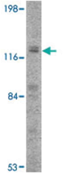 PCDH12, Rabbit, Polyclonal Antibody, Abnova 100&mu;g; Unlabeled:Antibodies,