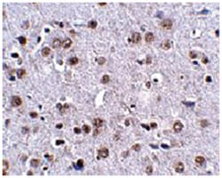 LRFN4, Rabbit, Polyclonal Antibody, Abnova 100&mu;g; Unlabeled:Antibodies,