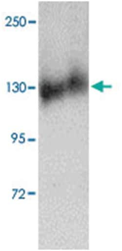 FKBP15, Rabbit, Polyclonal Antibody, Abnova 100&mu;g; Unlabeled:Antibodies,