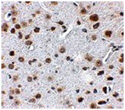 FTO, Rabbit, Polyclonal Antibody, Abnova 100&mu;g; Unlabeled:Anticuerpos