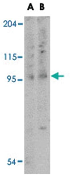 TNFAIP3 Rabbit anti-Human, Mouse, Rat, Polyclonal Antibody, Abnova 100 &mu;g | Buy Online | Abnova Corporation | Fisher Scientific