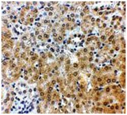 NPC1 Rabbit anti-Human, Polyclonal Antibody, Abnova 100 &mu;g | Buy Online | Abnova Corporation | Fisher Scientific