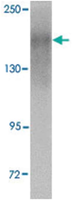 NPC1 Rabbit anti-Human, Polyclonal Antibody, Abnova 100 &mu;g | Buy Online | Abnova Corporation | Fisher Scientific