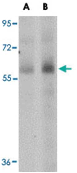 SCARB1 Rabbit anti-Human, Mouse, Rat, Polyclonal Antibody, Abnova 100 &mu;g | Buy Online | Abnova Corporation | Fisher Scientific