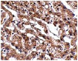 MACC1, Rabbit, Polyclonal Antibody, Abnova 100&mu;g; Unlabeled:Antibodies,
