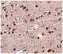 MC4R Rabbit anti-Human, Mouse, Rat, Polyclonal Antibody, Abnova 100&mu;g;