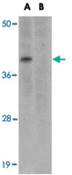 MC4R Rabbit anti-Human, Mouse, Rat, Polyclonal Antibody, Abnova 100&mu;g;