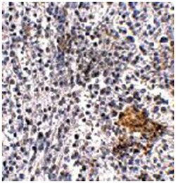 SHOC2, Rabbit, Polyclonal Antibody, Abnova 100 &mu;g | Buy Online | Abnova Corporation | Fisher Scientific