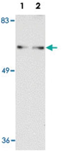 SHOC2, Rabbit, Polyclonal Antibody, Abnova 100 &mu;g | Buy Online | Abnova Corporation | Fisher Scientific