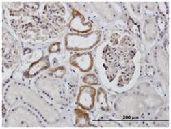 AFAP1L2 Rabbit anti-Human, Mouse, Rat, Polyclonal Antibody, Abnova 100 &mu;g | Buy Online | Abnova | Fisher Scientific