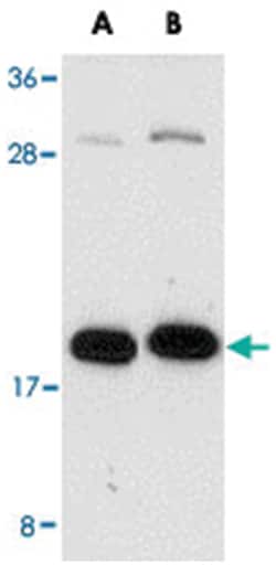 ZCRB1, Rabbit, Polyclonal Antibody, Abnova 100 &mu;g | Buy Online | Abnova | Fisher Scientific