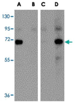 Seasonal H1N1 Hemagglutinin Rabbit anti-Viruses, Polyclonal Antibody, Abnova 100 &mu;g | Buy Online | Abnova Corporation | Fisher Scientific