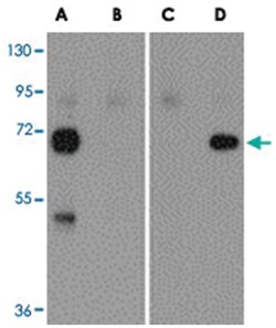 Seasonal H1N1 Hemagglutinin Rabbit anti-Viruses, Polyclonal Antibody, Abnova 100 &mu;g | Buy Online | Abnova Corporation | Fisher Scientific