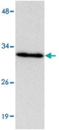 HAAO Rabbit anti-Human, Mouse, Rat, Polyclonal Antibody, Abnova 100 &mu;g | Buy Online | Abnova Corporation | Fisher Scientific
