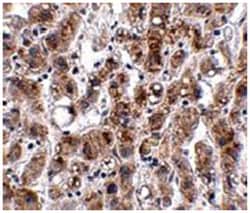 ACOT13, Rabbit, Polyclonal Antibody, Abnova 100&mu;g; Unlabeled:Antibodies,