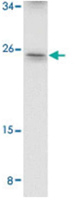 ARL15 Rabbit anti-Human, Mouse, Rat, Polyclonal Antibody, Abnova 100&mu;g;
