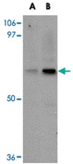 UBQLN4, Rabbit, Polyclonal Antibody, Abnova 100&mu;g; Unlabeled:Antibodies,
