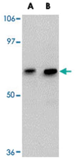 GALNT10 Rabbit anti-Human, Mouse, Rat, Polyclonal Antibody, Abnova 100&mu;g;