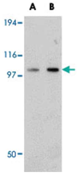 FAM120B, Rabbit, Polyclonal Antibody, Abnova 100 &mu;g | Buy Online | Abnova Corporation | Fisher Scientific