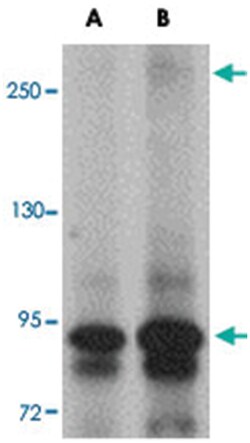 JMJD1C, Rabbit, Polyclonal Antibody, Abnova 100&mu;g; Unlabeled:Antibodies,