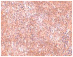 JMJD8, Rabbit, Polyclonal Antibody, Abnova 100&mu;g; Unlabeled:Antibodies,