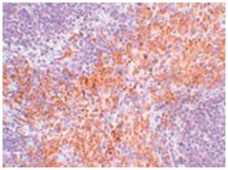 RIPK1 Rabbit anti-Human, Mouse, Rat, Polyclonal Antibody, Abnova 100 &mu;g | Buy Online | Abnova | Fisher Scientific