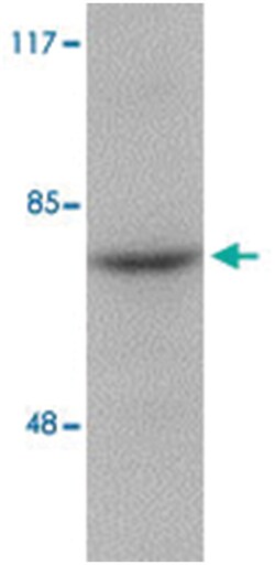 RIPK1 Rabbit anti-Human, Mouse, Rat, Polyclonal Antibody, Abnova 100 &mu;g | Buy Online | Abnova | Fisher Scientific