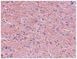 ProSAPiP1, Rabbit, Polyclonal Antibody, Abnova 100&mu;g; Unlabeled:Antibodies,