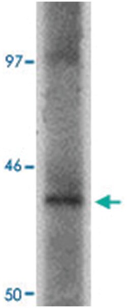ProSAPiP1, Rabbit, Polyclonal Antibody, Abnova 100&mu;g; Unlabeled:Antibodies,