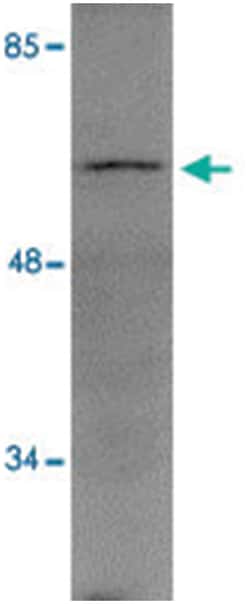 TBKBP1, Rabbit, Polyclonal Antibody, Abnova 100&mu;g; Unlabeled:Antibodies,