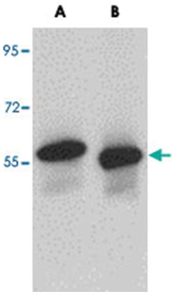 SKA3, Rabbit, Polyclonal Antibody, Abnova 100&mu;g; Unlabeled:Antibodies,