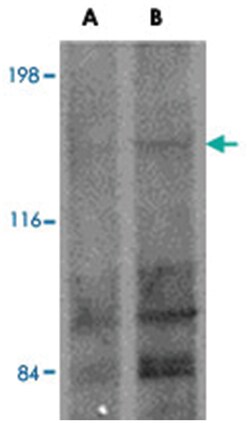 FRMPD1, Rabbit, Polyclonal Antibody, Abnova 100&mu;g; Unlabeled:Antibodies,