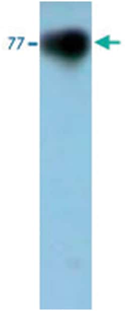 TF Rabbit anti-Human, Polyclonal Antibody, Abnova 500&mu;g; Unlabeled:Antibodies,